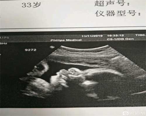深圳试管包男孩：濠江区一怀孕三月的社区“第