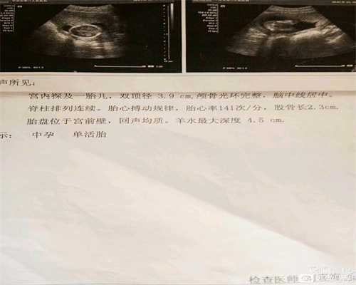 深圳不孕不育公立医院：徐州女子怀孕两个月，