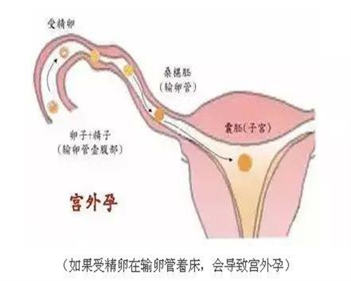 代孕机构有哪些,孕期常做的5个动作，最易伤到小