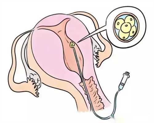 昆明代孕中介：孕妇口腔溃疡可以吃维生素B2吗孕