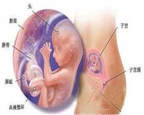 昆明代孕公司_怀孕初期腹泻对胎儿有影响吗